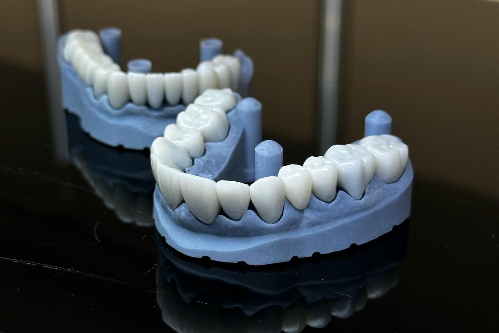 protesi dentali e corone in zirconia a Salerno